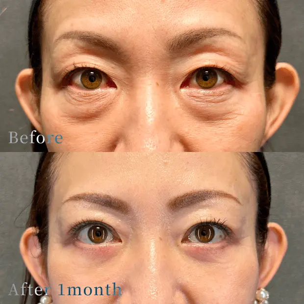 X CLINIC 症例写真 Before/After