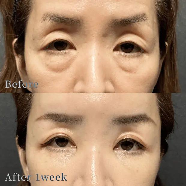 X CLINIC 症例写真 Before/After