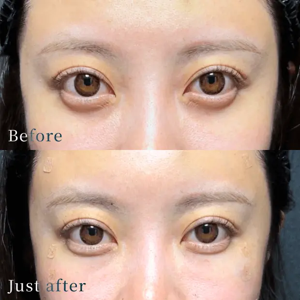 X CLINIC 症例写真 Before/After